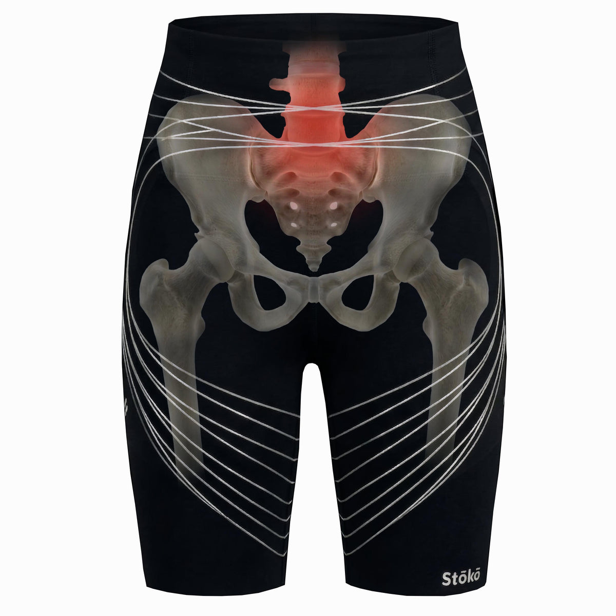 Injuries – Stoko® Canada