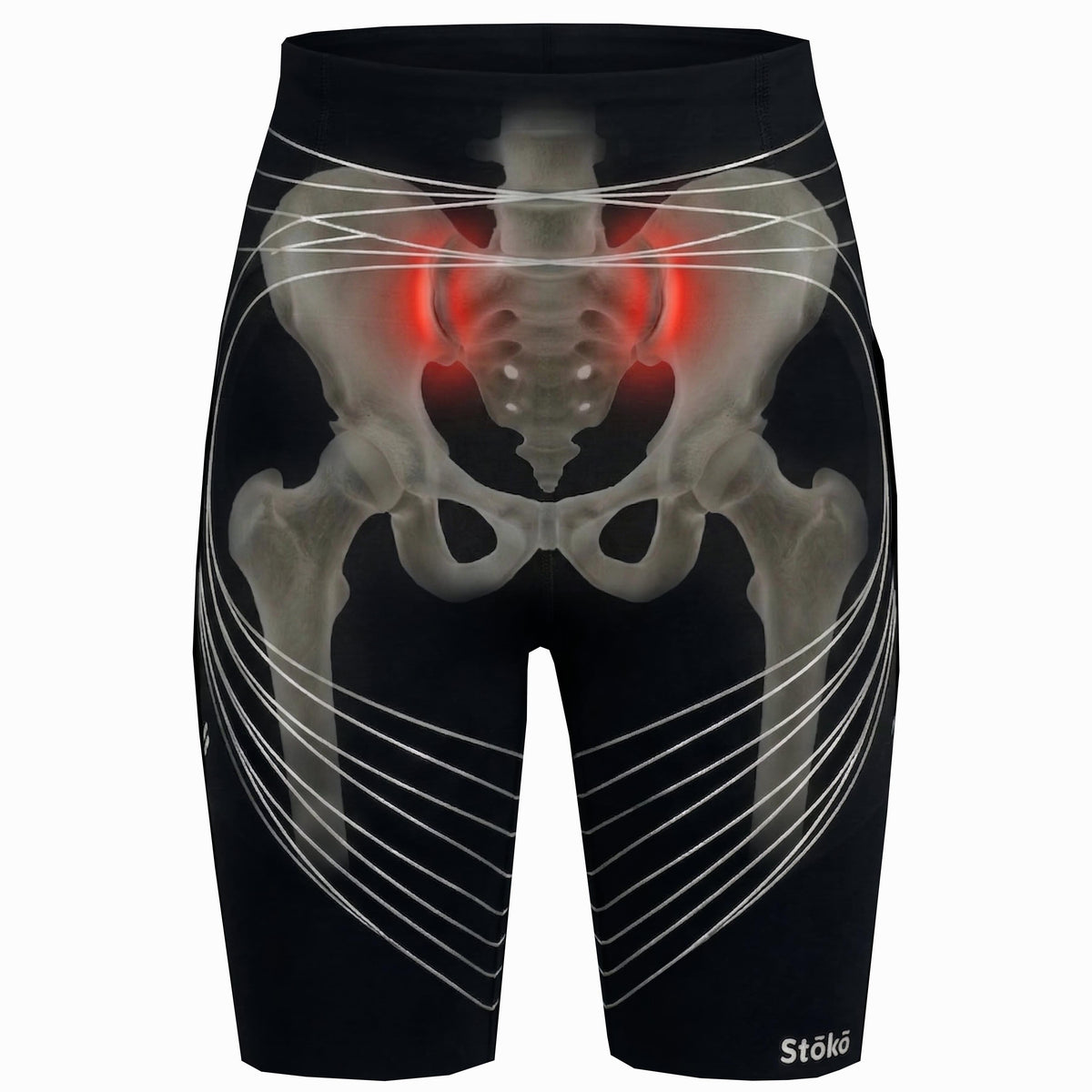 Injuries – Stoko® Canada